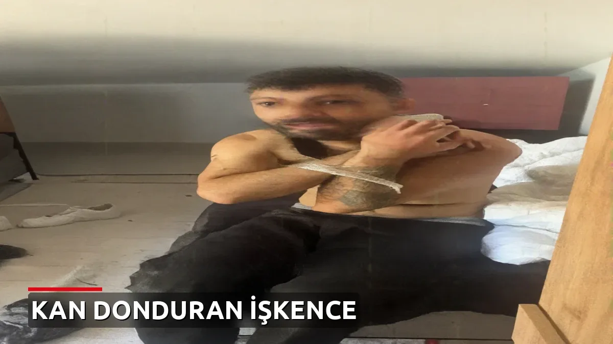 Kağıthane'de 3 gün süren kan donduran işkence: Sırtlarına naylon eritip bıçakla kestiler